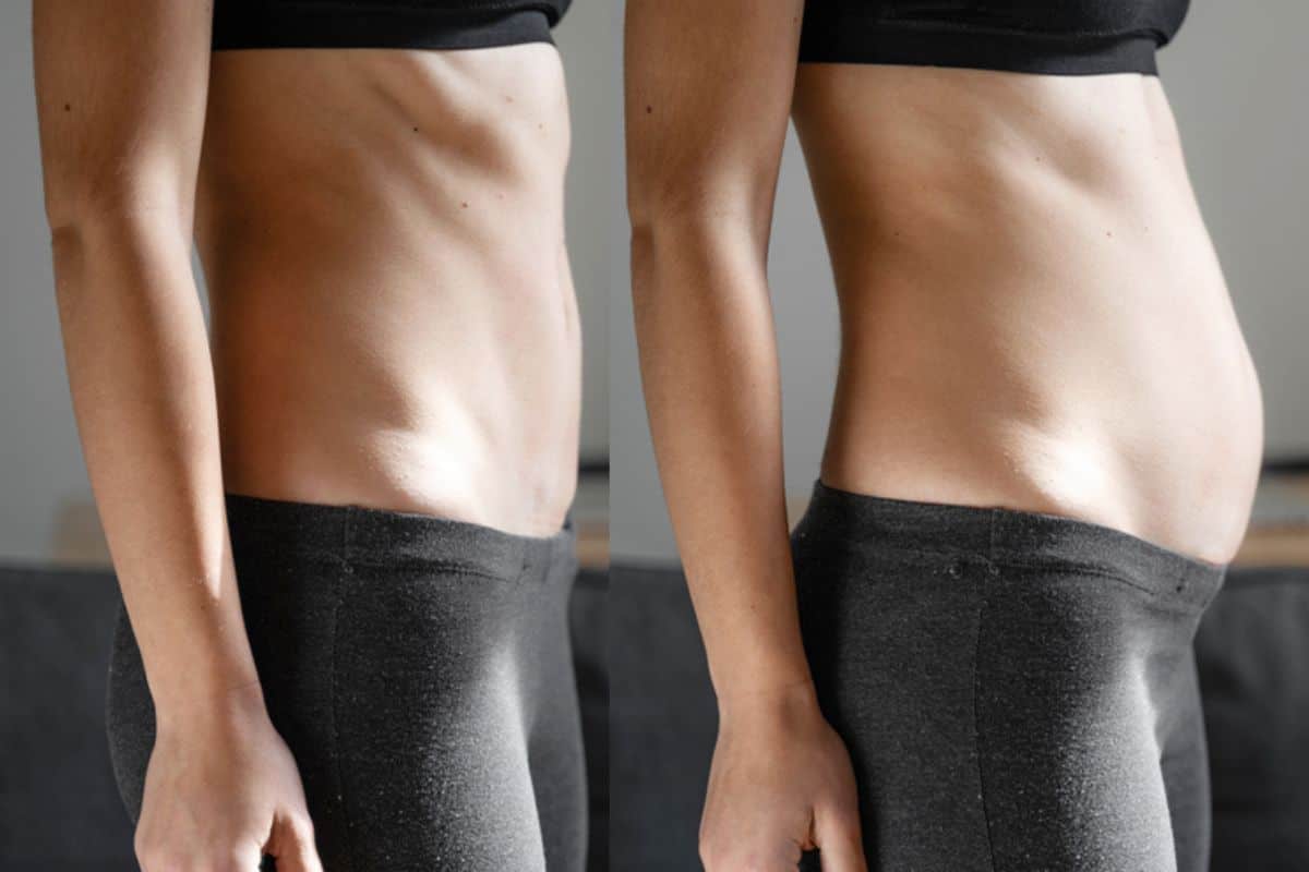 How long does diastasis recti take to improve Perivale?