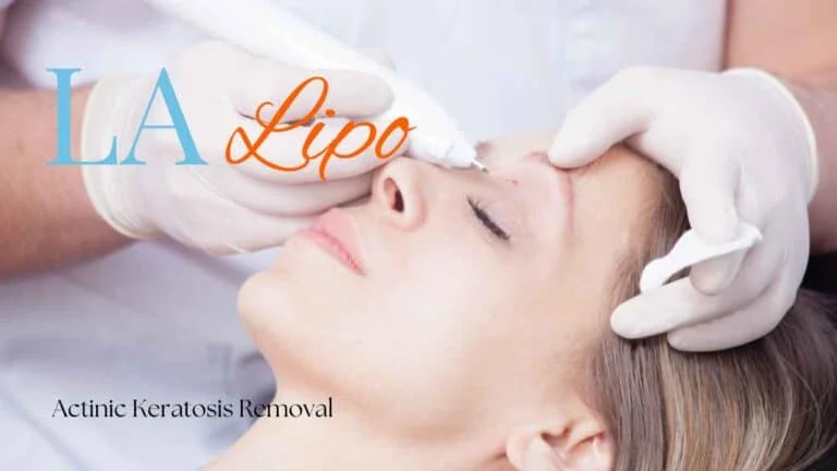 Woman receiving Actinic Keratosis Removal Treatment Perivale