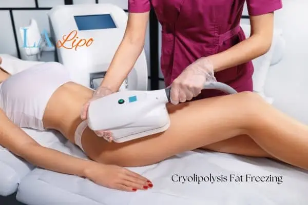 Woman receiving coolsculpting Perivale treatment on her thighs