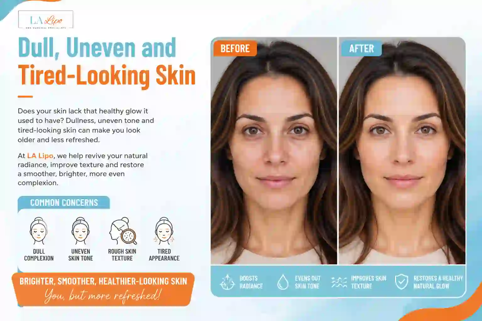 Sign #5: Dull, Uneven and Tired-Looking Skin Perivale