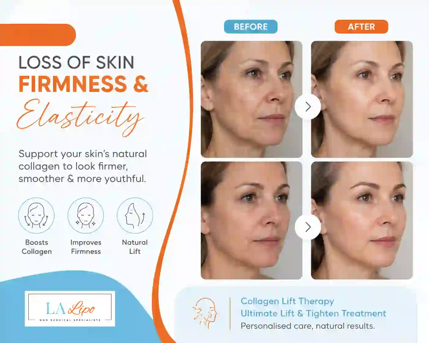 Sign #7: Loss of Skin Firmness and Elasticity Perivale
